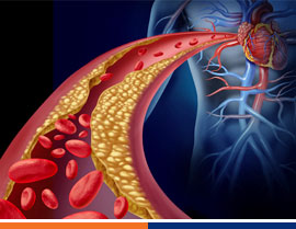 El antes síndrome metabólico, y el ahora síndrome cardio-metabólico