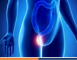 Tratamiento para hemorroides y cirugía láser hemorroidal mínimamente invasiva