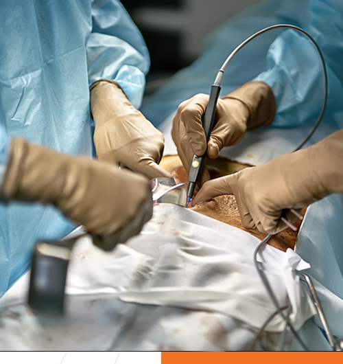 Hospital Puebla - Quiste Pilonidal Y Cirugía Con Láser